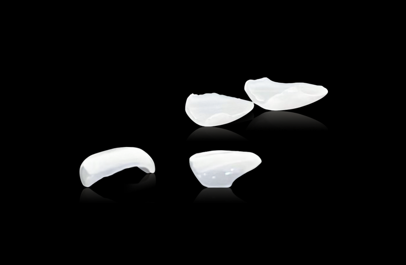 Wafer-Thin Veneers